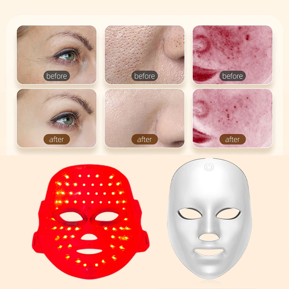 Rechargeable 7-Color LED Facial Mask - product photo 3